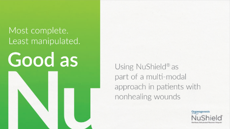 Using NuShield as part of a multi-modal approach in patients with nonhealing wounds