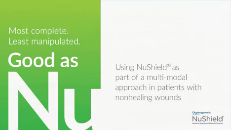 Using NuShield as part of a multi-modal approach in patients with nonhealing wounds